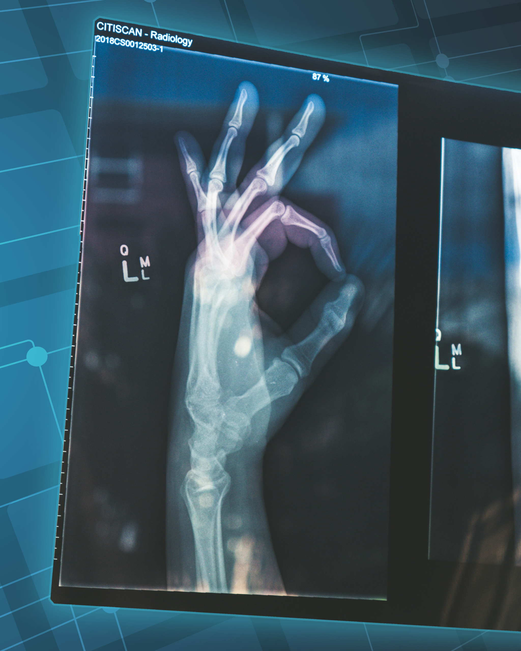 Image of a radiology report with a tech background.